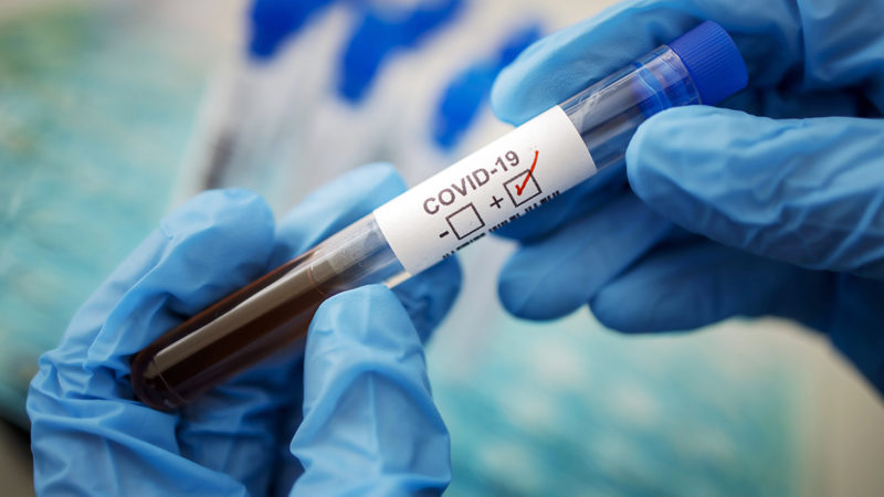 Почти у 300 ружан тесты на коронавирус дали отрицательный результат
